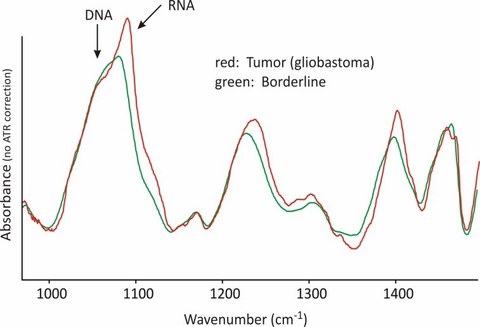 Infrarotspektren Tumor
